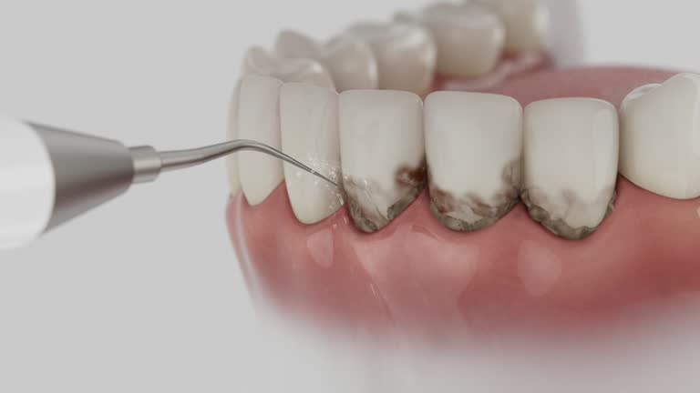 Reliable Wisdom Tooth Removal contractor in McDuffie County County, GA by Dentist Open Now